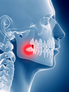 chirurgia stomatologiczna zatrzymany ząb